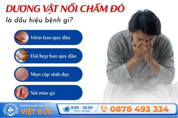 Dương vật bị nổi chấm đỏ xuất phát từ nhiều bệnh lý khác nhau