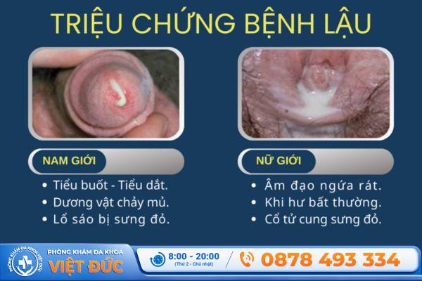 Tiểu ra mủ ở nam và nữ có thể là dấu hiệu của bệnh lậu