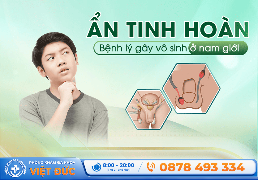 Phòng khám Việt Đức Bắc Ninh 28 Ẩn tinh hoàn: Bệnh lý gây vô sinh cao ở nam giới