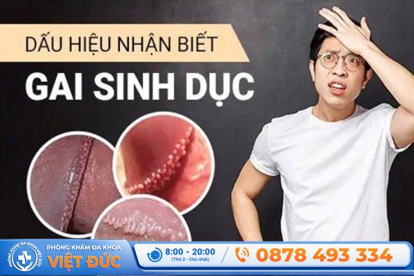 Phòng khám Việt Đức Bắc Ninh 4 Dấu hiệu nhận biết gai sinh dục