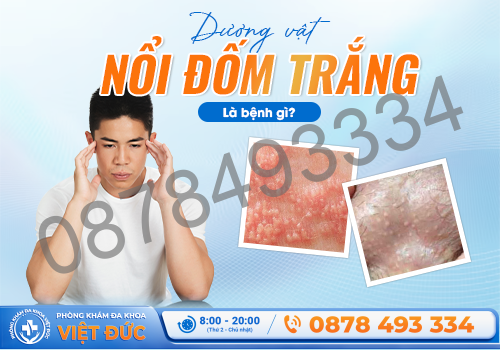 Phòng khám Việt Đức Bắc Ninh 6