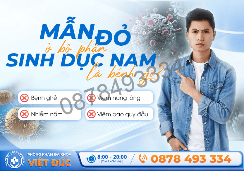 Mẩn đỏ bộ phận sinh dục nam là bệnh gì?