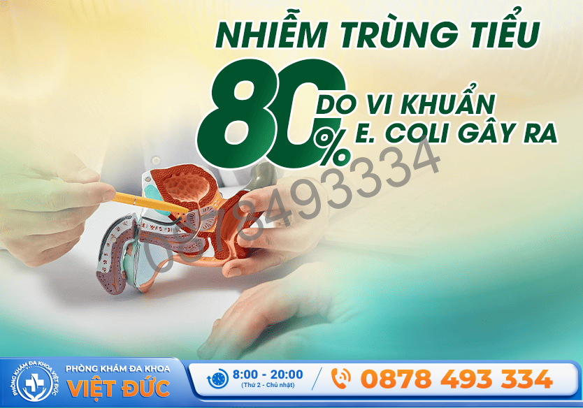 Khoảng 80% trường hợp nhiễm trùng tiết niệu do khuẩn E.coli gây ra
